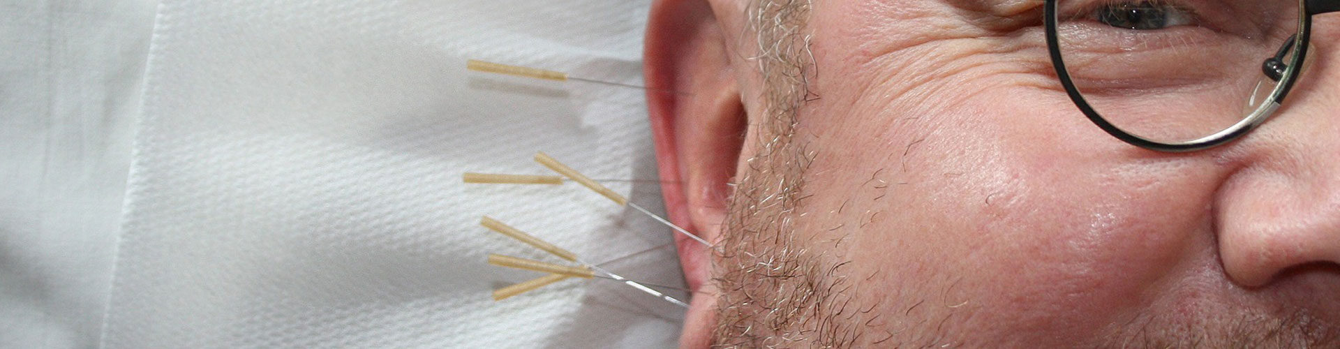 Colorado Springs Acupuncture Treatments | Listening Heart Medicines